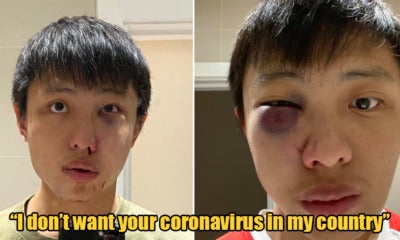 S'Porean Guy In London Was Attacked - World Of Buzz