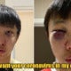 S'Porean Guy In London Was Attacked - World Of Buzz