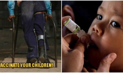 Kkm: One More Polio Case In Sabah Brings Total - World Of Buzz