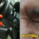Man Uses Pressurized Water Can With 75% Alcohol To Disinfect Car, Suffers Severe Eyeball Injury - World Of Buzz