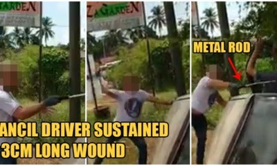 Kelantan Road Bully Violently Beats Up Kancil Driver Who Crashed Into Ditch For Overtaking Him - World Of Buzz 3