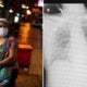 Thai Woman Ends Up In Icu After Her Daughter Didn'T Self-Quarantine Af - World Of Buzz