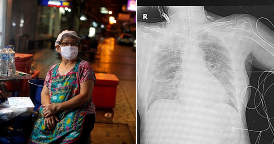 Thai Woman Ends Up in ICU After Her Daughter Didn't Self-Quarantine Af - WORLD OF BUZZ