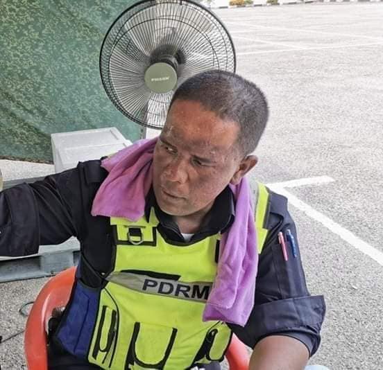 Viral Photos Show Pdrm Officers With Deep Tan Marks After Manning Mco Roadblocks Daily - World Of Buzz