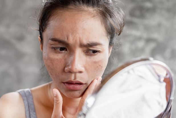 acne woman stress