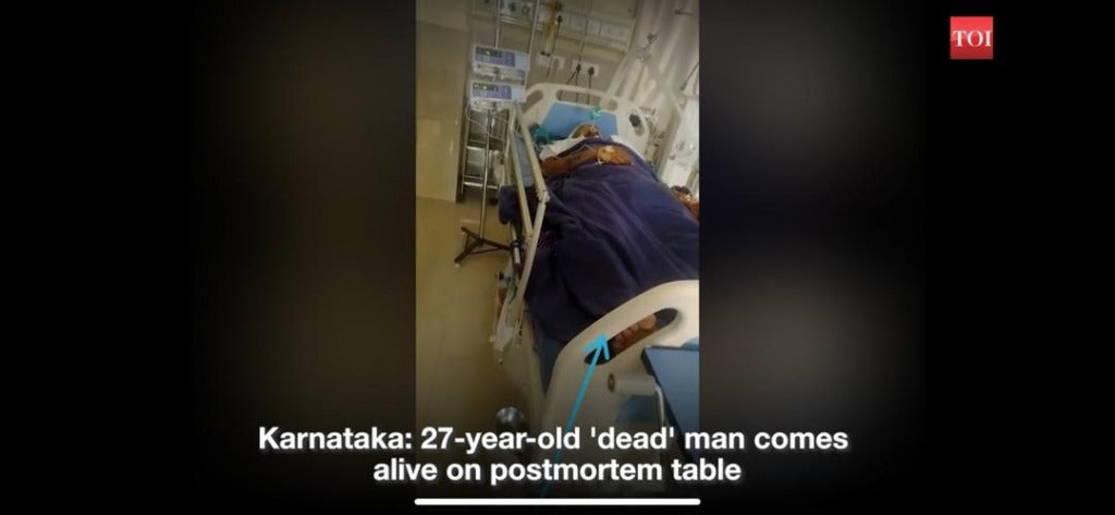 Indian Man Declared Dead "Comes Back To Life" On Autopsy Table As