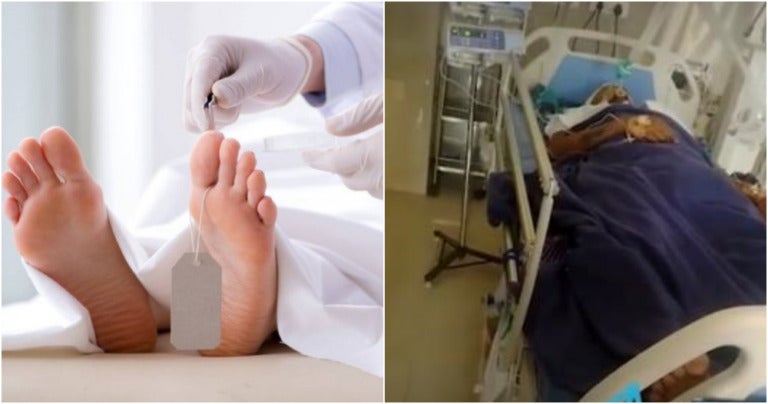 Indian Man Declared Dead "Comes Back To Life" On Autopsy Table As