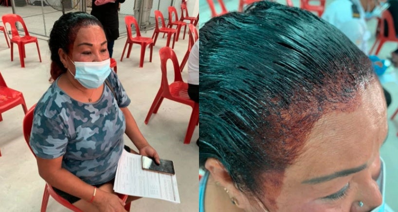 Aunty Go Vaccination With Hair Dye