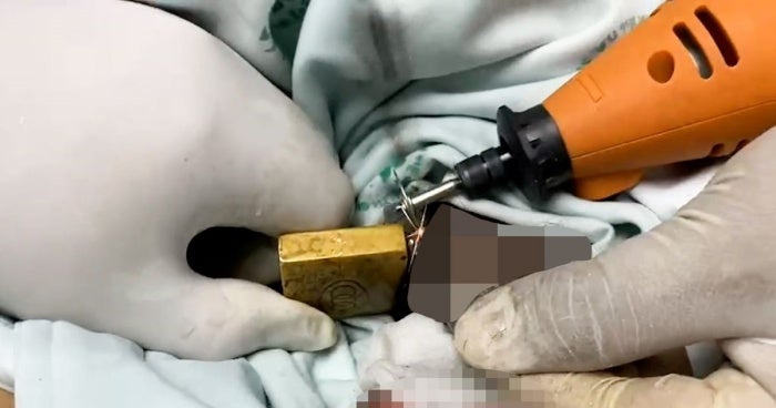 surgery on mans penis