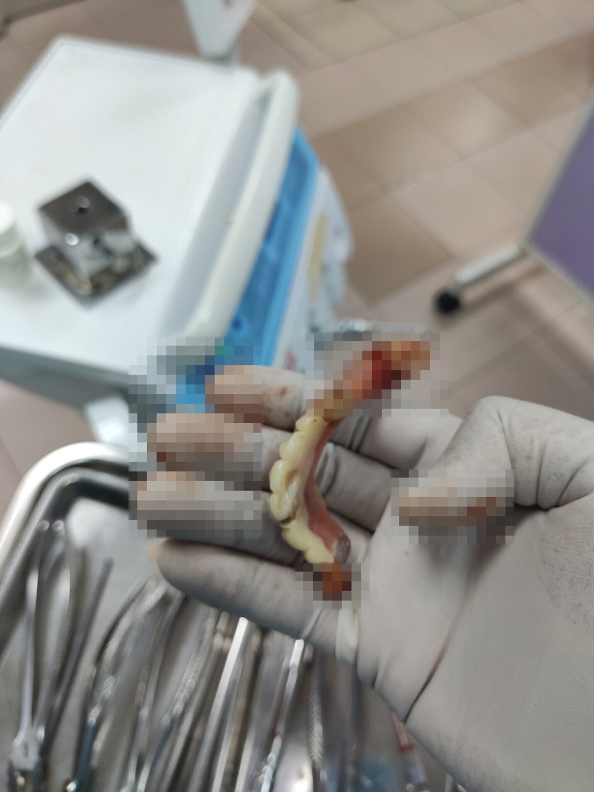 fake dentures fake dentist 4 2