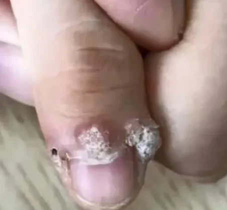 e5a5b3e5ad90e5819ae7be8ee794b2e6849fe69f93hpv e68c87e7bc9de995bfe587bae2809ce88f9ce88ab1e2809de5a5bde58fafe68095efbc81