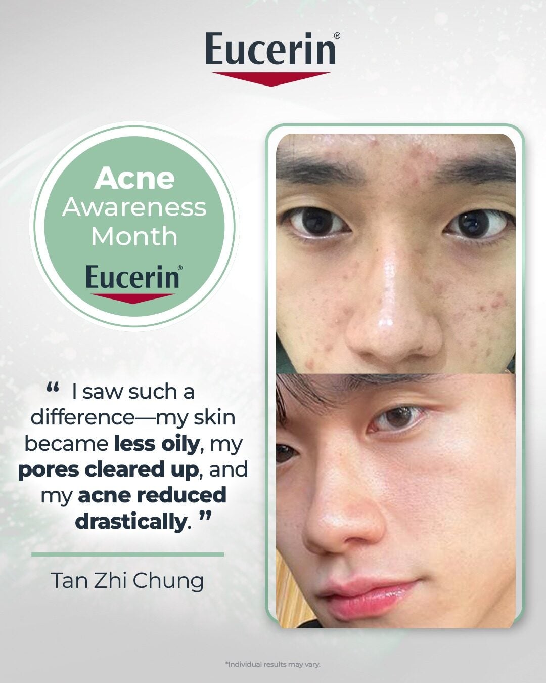 Eucerinproacneq2 Tan Zhi Chung