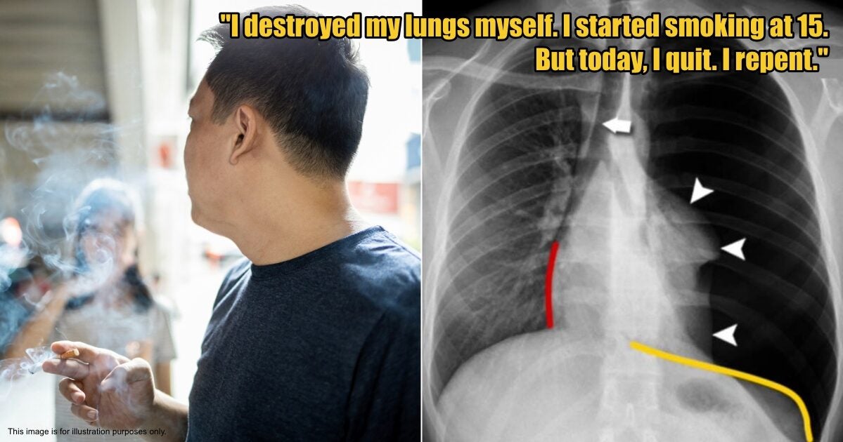 My Post 1 2025 06 05T102158.069