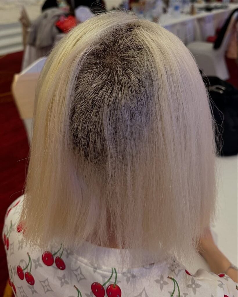 여러분 탈색 조심하세요 사진보고 놀라셨죠.여러분들께 예쁜 모습을 보여드리고 싶은 마음에 3년 만에 금발소다로 깜짝 변신하려고 한국에 돌아와 평소 다니던 샵에서 탈색을 2