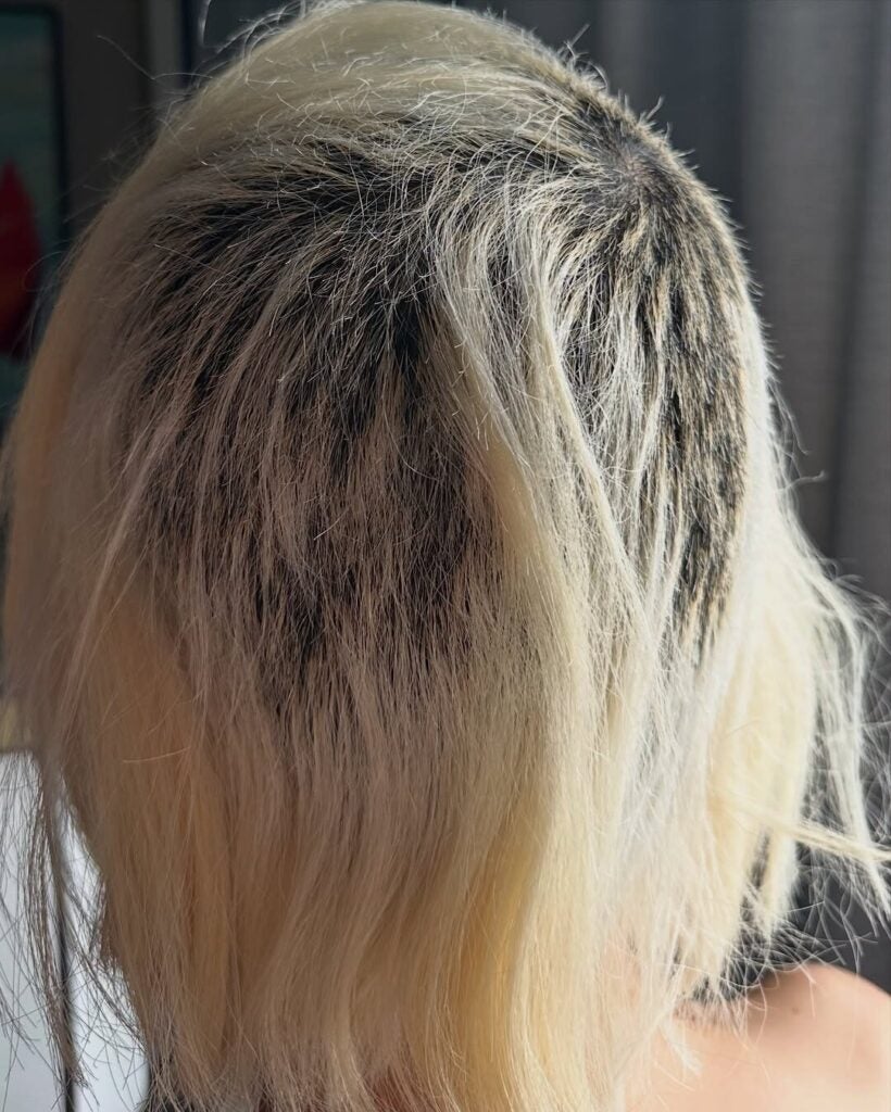 여러분 탈색 조심하세요 사진보고 놀라셨죠.여러분들께 예쁜 모습을 보여드리고 싶은 마음에 3년 만에 금발소다로 깜짝 변신하려고 한국에 돌아와 평소 다니던 샵에서 탈색을 3