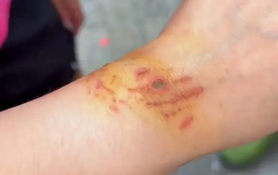 f56e793cac71c4bd0caa0a2a699658cd