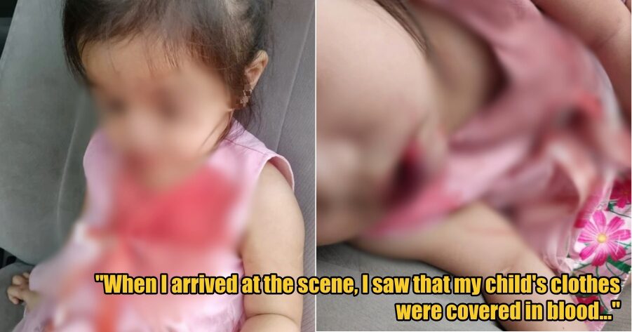 3yo Girl Sustains Severe Injuries After Jumping Out of Car on Her First Day of Preschool in Pahang